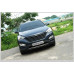 ARTX LUXURY CARBON TUNING GRILLE SET HYUNDAI SANTA FE DM 2012-15